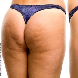 ILHA DO SEXO