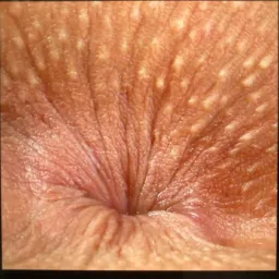 Putaria é pornografia